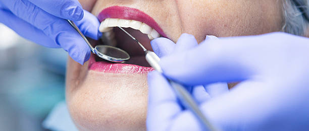 Best Broken or Cracked Tooth Emergency Dentist in Naples Park, FL